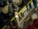 Syrský chlapec zranný pi bombardování Aleppa (4. íjna 2012)