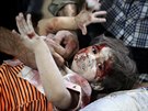 Syrští zdravotníci ošetřují dítě zraněné při náletu na damašské předměstí Dúma...