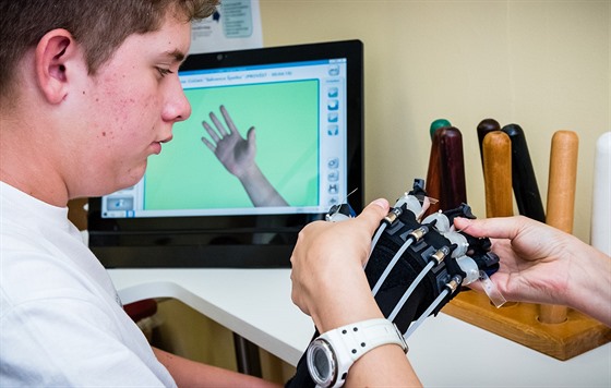 Robotická ruka pomáhá nacviovat pohyby prst a zápstí. Její obraz se promítá...
