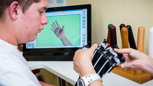 Robotická ruka pomáhá nacvičovat pohyby prstů a zápěstí. Její obraz se promítá na monitoru.