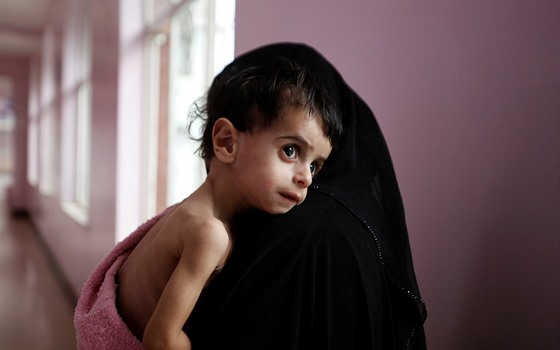 Podle OSN nemá dostatek jídla polovina z téměř 28 milionů Jemenců. Na 370 tisíc...
