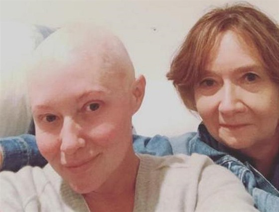 Shannen Doherty kvli chemoterapii vypadaly vlasy (2016).
