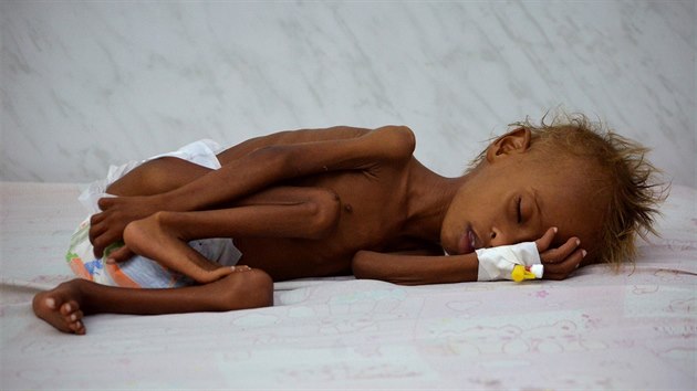 Podle OSN nemá dostatek jídla polovina z téměř 28 milionů Jemenců. Na 370 tisíc dětí je těžce podvyživených.  (26.9.2016)