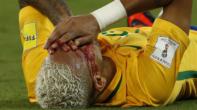 Brazilsk hvzda Neymar se pi utkn s Bolvi zranil.