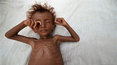 Podle OSN nemá dostatek jídla polovina z tém 28 milion Jemenc. Na 370 tisíc...