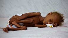 Podle OSN nemá dostatek jídla polovina z tém 28 milion Jemenc. Na 370 tisíc...