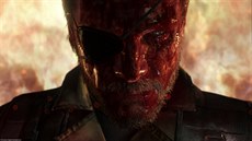Metal Gear Solid V: The Phantom Pain