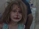 Vydená dívka hledá v syrské nemocnici svého otce