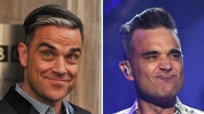 Robbie Williams propadl kouzlu plastik a kosmetických zákrok
