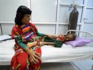 Osmnáctiletá Jemenka trpí extrémní podvýivou (25. íjna 2016)
