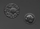 Pátý den vývoje. Zde je jasn vidt postupující embryo ve stadiu blastocysty...