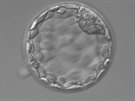Takto by mlo vypadat embryo pátý den po oplození.