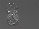 Embryo opoutjící obal ped implantací. Embryo se musí uvolnit z obalu...