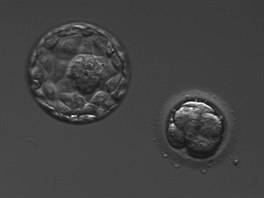 Pátý den vývoje. Zde je jasně vidět postupující embryo ve stadiu blastocysty...