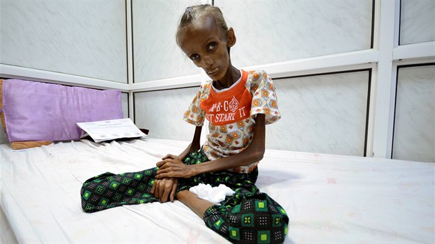 Osmnáctiletá Jemenka trpí extrémní podvýživou. (25. října 2016)