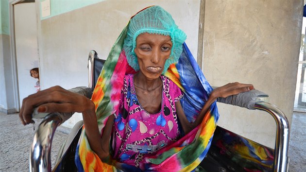 Osmnctilet Jemenka trp extrmn podvivou (25. jna 2016)