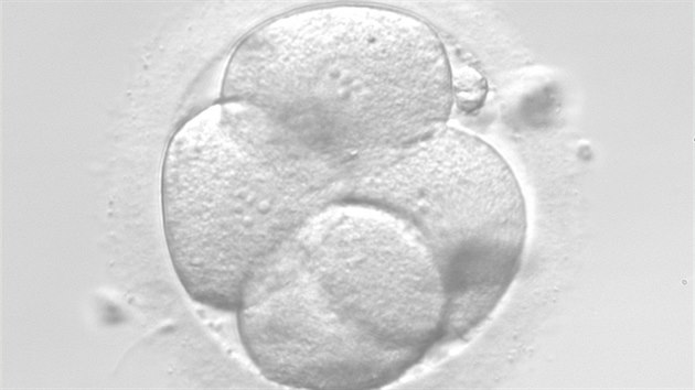 Druhý den po oplození se vajíčko rozdělí na 2 až 4 buňky. „Důležité je, aby dělení bylo pravidelné a buňky stejné,“ říká embryoložka.