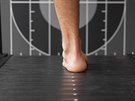 Pronaní dolap - výrazné vytáení chodidel na vnitní hranu