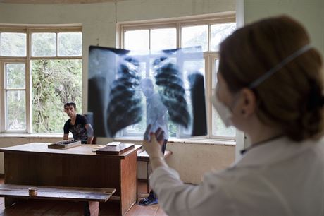 Tuberkulóza, zejména multirezistentní, se vlády nad pacientovým tlem nevzdává...