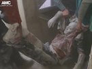 Zniená nemocnice a dalí následky nálet v Aleppu