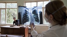 Tuberkulóza, zejména multirezistentní, se vlády nad pacientovým tělem nevzdává...