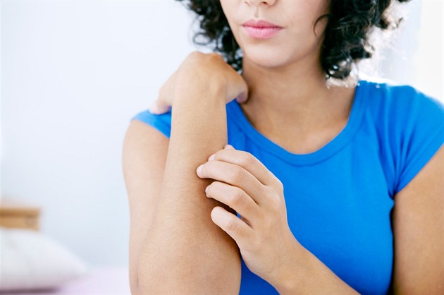 Atopická dermatitida dokáže potrápit. Jak pečovat o suchou kůži?