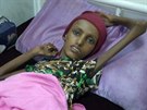 Lékai zachránili vyhublou dívku z Jemenu
