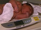 V Melbourne se narodilo estikilové novorozen