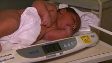 estikilové miminko miminko se narodilo v Melbourne.