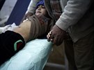 Chlapec zranný v Mosulu pi útoku, který IS podnikl pomocí dronu naloeného...