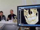 Skenování mumie barona Trencka (25. února 2017).
