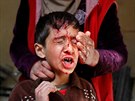 Irácký chlapec zranný v bojích v západním Mosulu (28. února 2017)