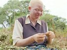 Regulace tradiní medicíny pome v boji proti obchodu s orgány albín