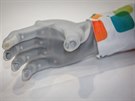 Nejmodernjí bionická ruka stojí pes milion korun.