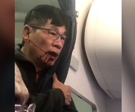 David Dao byl po násilném vyvleený z letadla zmatený a celý od krve.