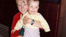 Pen�ze na bionickou ruku jsou p�ipraven� i pro dal�� sedmn�ctiletou studentku Terezu Nahodilovou z T�eb��e.