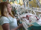 Havlkobrodsk nemocnice se kvli velk rekonstrukci porodnice zaala postupn...