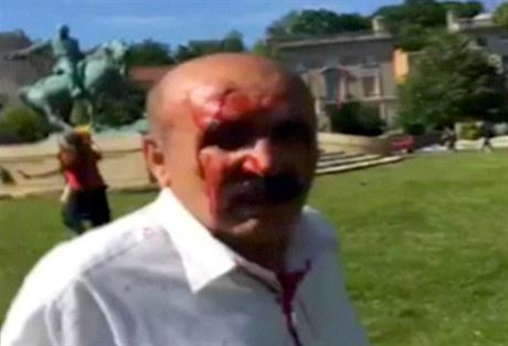 Jeden z lidí zranných pi bitce u rezidence tureckého velvyslance ve...