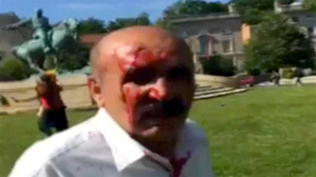 Jeden z lid zrannch pi bitce u rezidence tureckho velvyslance ve Washingtonu (16. kvtna 2017)