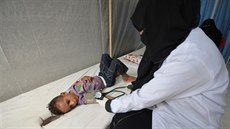 V Jemenu se �í�í cholera, zdravotnických za�ízení v zemi je v�ak kv�li válce...