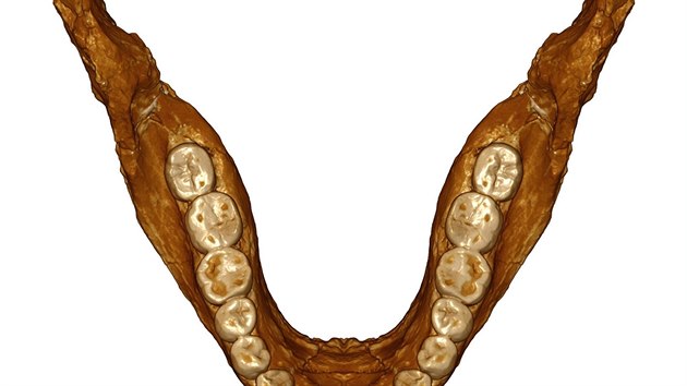 Pohled na spodn elist nalezenou na hoe Irhd. Je velmi podobn elisti dnench lid, ale rozdly se najdou: zuby jsou napklad o nco mohutnj.