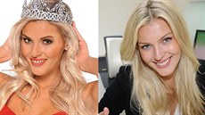 Linda Barto�ová p�ed zákrokem a po n�m