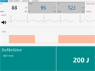 Monitor zobrazuje ivotní funkce stejn jako u skuteného pacienta.