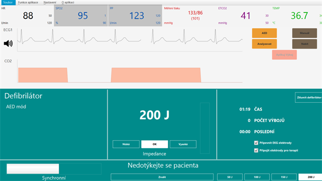 Monitor zobrazuje ivotn funkce stejn jako u skutenho pacienta.