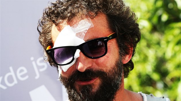 Ondřej Vetchý dorazil na prezentaci filmu Po strništi bos se zraněným okem (6. července 2017).