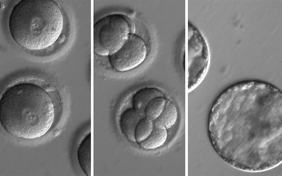 Chronologická sekvence vývoje geneticky upravených lidských embryí z dílny týmu...
