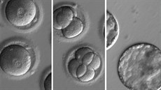 Chronologická sekvence vývoje geneticky upravených lidských embryí z dílny týmu...