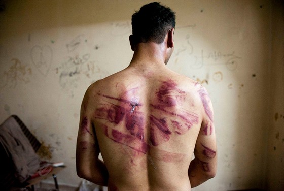 Svědectví o brutálních praktikách v syrských vězeních před lety podal také...