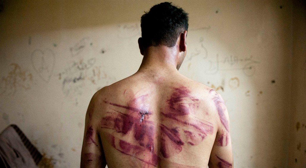Svědectví o brutálních praktikách v syrských vězeních před lety podal také...