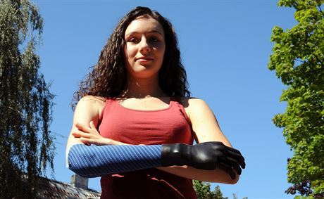 Díky dobroinnosti lidí si Kamila abrulová u bionickou ruku nemusí jen...